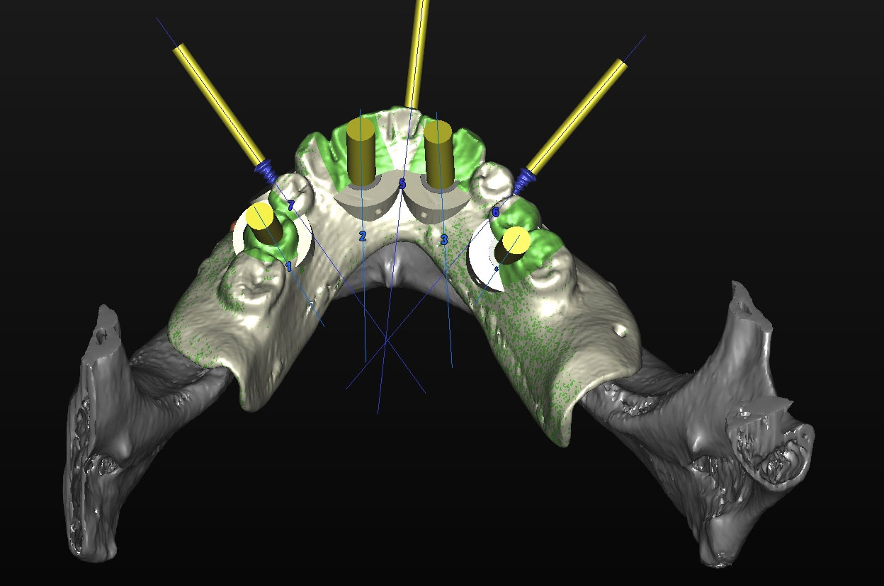 progettazione 3d